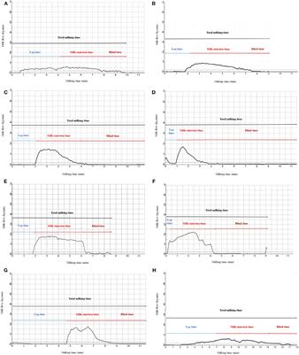 Study of Milkability and Its Relation With Milk Yield and Somatic Cell in Mediterranean Italian Water Buffalo